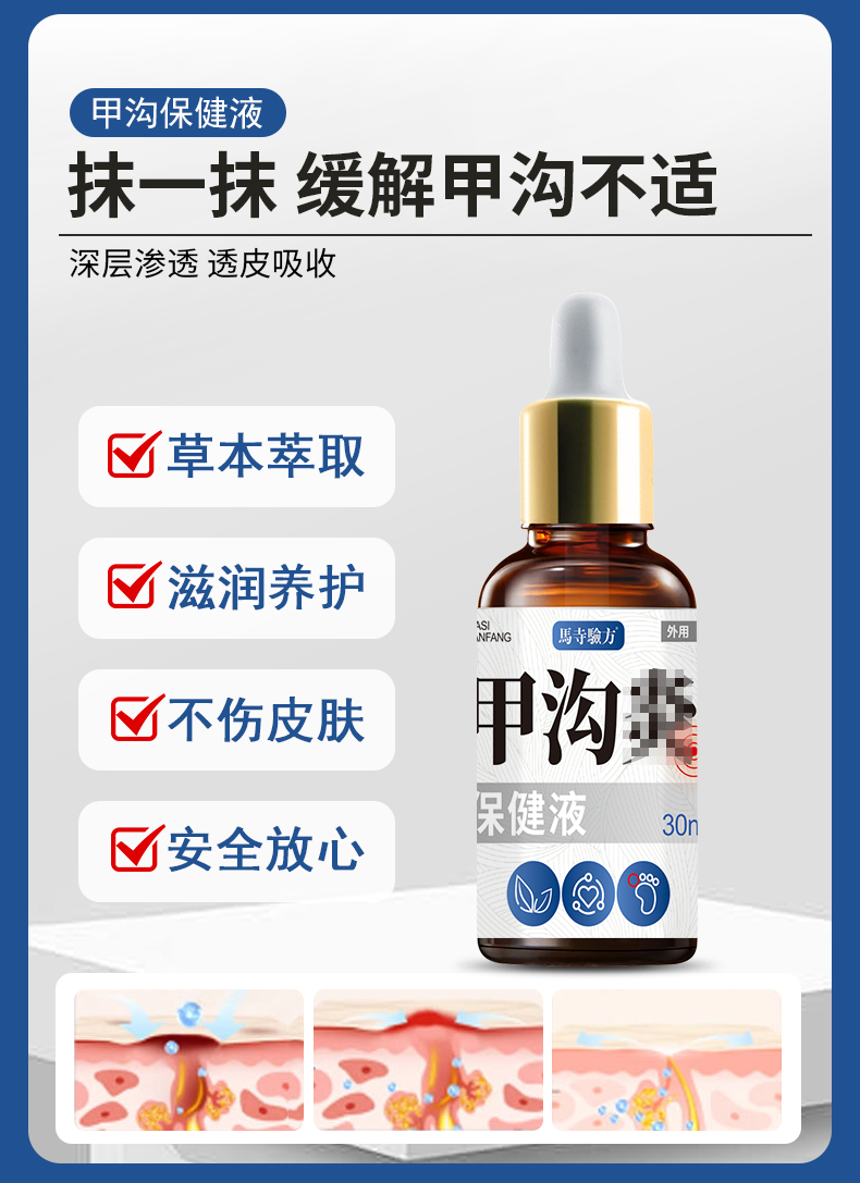 抹一抹，緩解甲溝不適